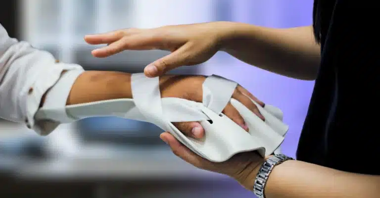 Splint service for hand injury rehabilitation of occupational therapy clinic, illustrating the topic of "Occupational Therapy ICD-10 Codes."